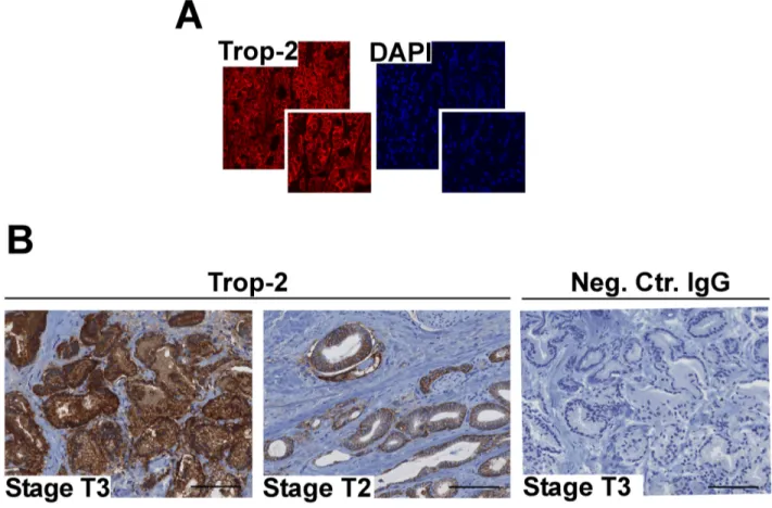Figure 1: Trop-2 localization and expression in PCa.  A. Localization of Trop-2 as investigated by IF staining and confocal 