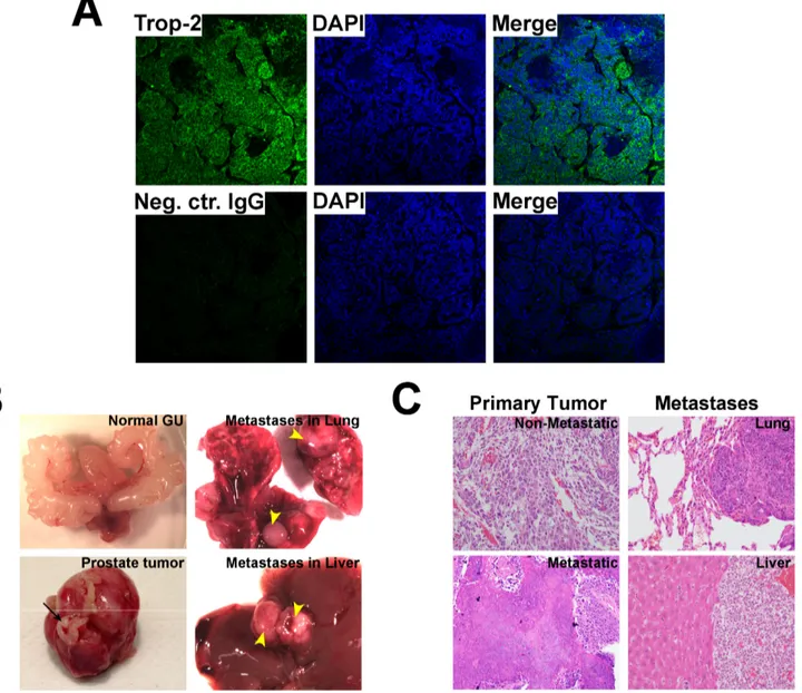 Figure 2: Analysis of Trop-2 expression in metastatic PCa from TRAMP mice.  A. IF analysis of Trop-2 expression in 