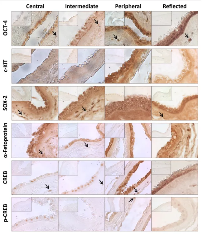 Figure 2. Immunohistochemistry in light microscopy. Photomicrographs depicting the immunohistochemical reaction for OCT-4, c-KIT, SOX-2, a-fetoprotein, CREB, and p-CREB in the central, intermediate, peripheral, and reflected areas (original magnification: 