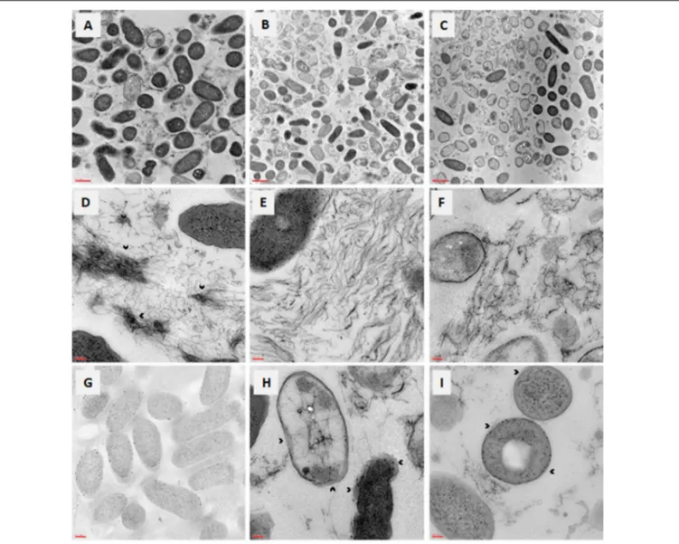 FIGURE 5 | In vitro activity of AgNPs against preformed biofilm: TEM observation. Biofilm samples by P