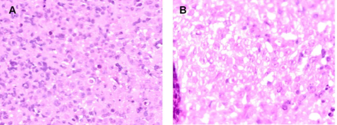 Figure 6.  Histological analysis (100 × magnification) of neoplastic masses excised from 