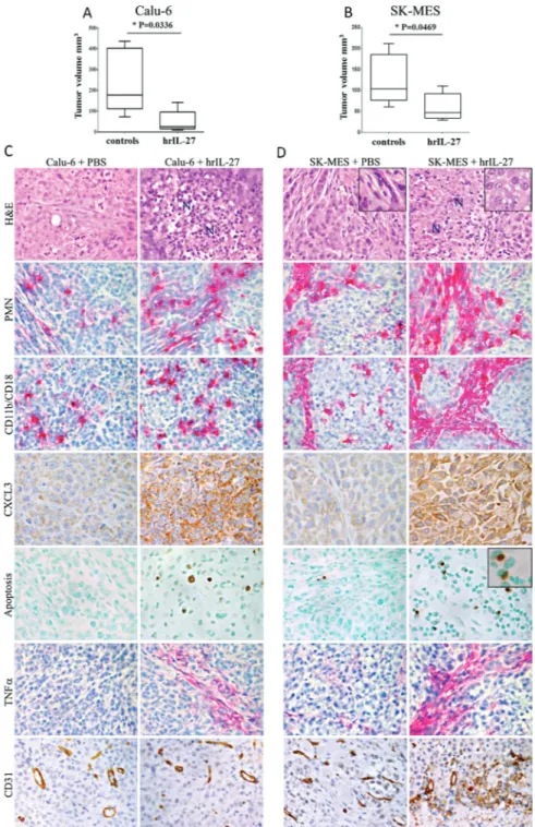 Figure 2: Antitumor Effects of IL-27 in Immunodeficient Pre-Clinical Models of Lung AC and SCC and Histopathological  Analyses of the Tumor Growth or Regression Areas