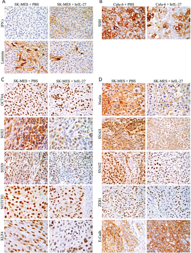 Figure 3: Expression of IFNγ and Down-Modulation of Stemness Genes and EMT-Regulating Transcription Factors by  IL-27 in SK-MES Tumors in vivo
