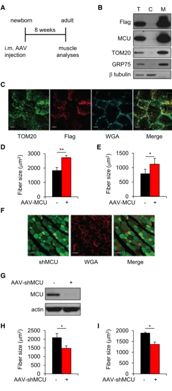 Figure 2. MCU Controls Muscle Size during Post-natal