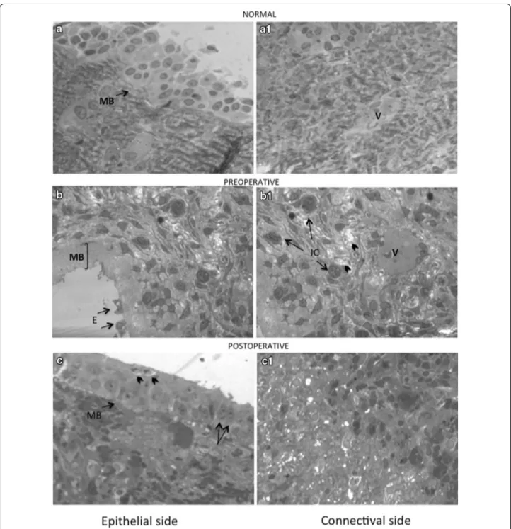 Fig. 1  Structural patterns in control, preoperative and postoperative specimens of nasal mucosa (40×)