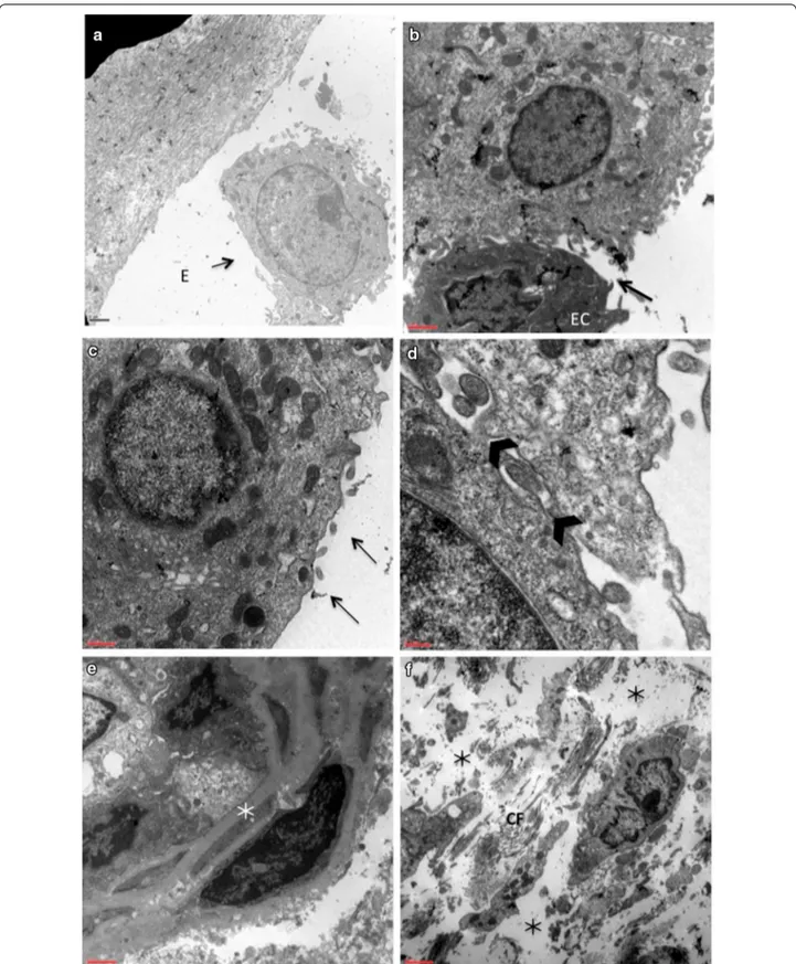Fig. 2  Ultrastructural patterns in preoperative specimens of nasal mucosa. a Epithelial cell (EC) flaking off from a thickened basement membrane 