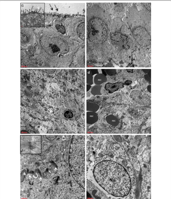 Fig. 3  Ultrastructural patterns in postoperative specimens of nasal mucosa. a Re-epithelisation with increased cell proliferation (arrowhead) and 