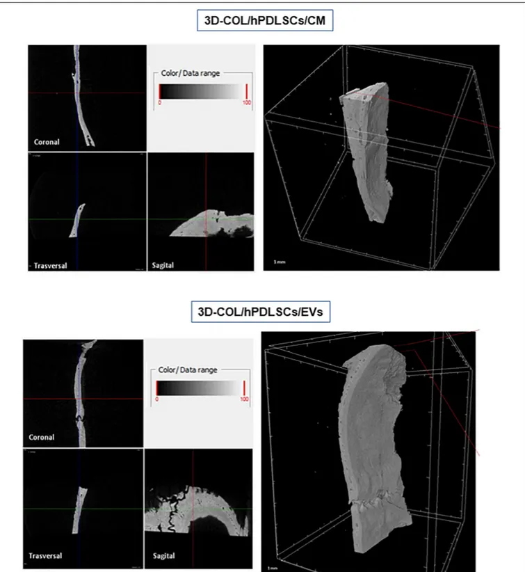 FIGURE 7 | Micro-computed tomography (CT) analyses. 3D virtual histologic evaluation in volume rendering visualization modality of 3D-COL/hPDLSCs/CM and 3D-COL/hPDLSCs/EVs, with 2D virtual sectioning in the 3 orthogonal planes.