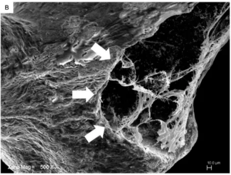 Figure 2. SEM microphotographs of hPDLSCs cultured in the presence of Endobon ® Xenograft Granules (G) after 7 days of incubation