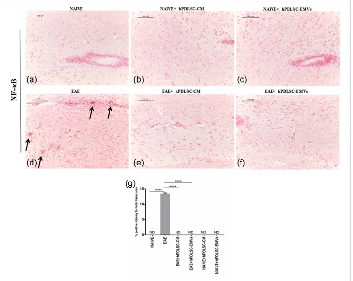 Figure 5.  RR-MS patients–derived hPDLSCs-CM and purified EMVs prevents NF-κB expression in EAE mice