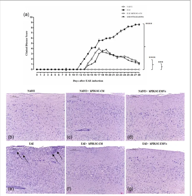 Figure 1.  RR-MS patients–derived hPDLSCs-CM and purified EMVs reduce EAE progression