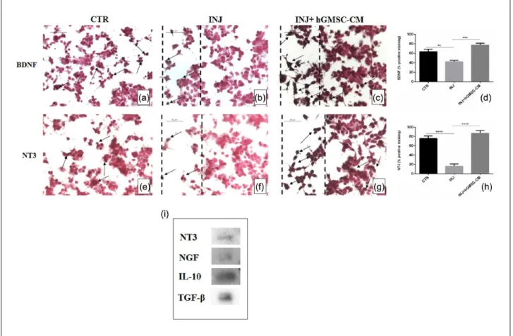 Figure 6.  hGMSC-CM augments neurotrophic factors in injured NSC-34 cells and expression of NT3, NGF, IL-10, and TGF-