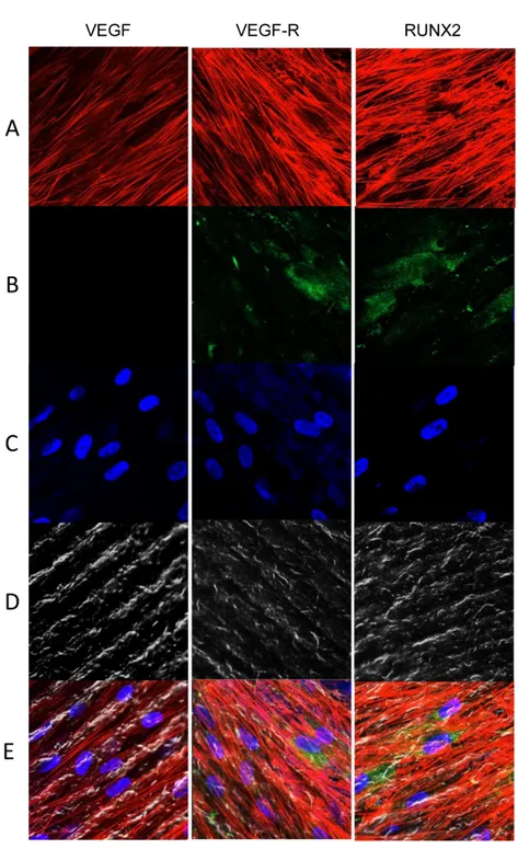 Figure 6. Human PDLSCs cultured on TEST titanium implant surface were observed after 1 week of  incubation