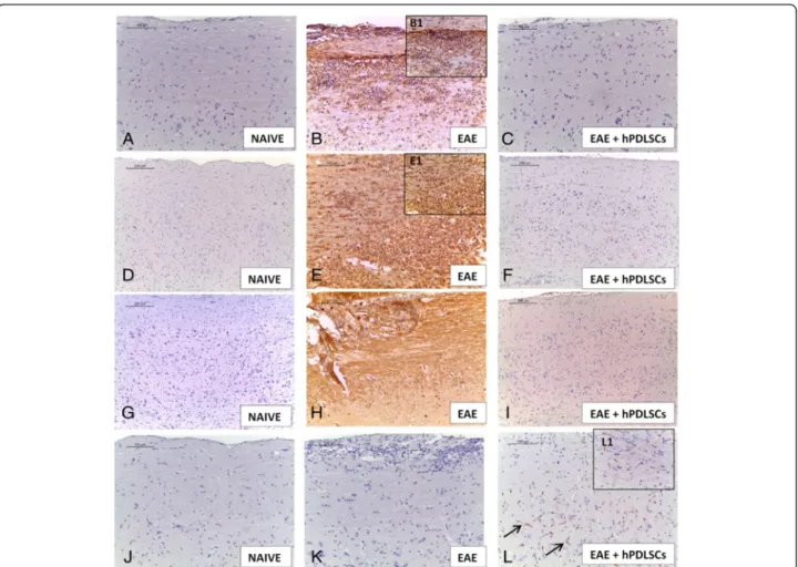 Fig. 4 Immunohistochemical evaluation for CD4, CD8 α, IL-1β and IL-10. CD4 and CD8α expression reveals higher tissue levels of these markers in experimental autoimmune encephalomyelitis ( EAE)-affected mice (b, 20×, B1 magnification, 40×; e, 20×, E1 magnif