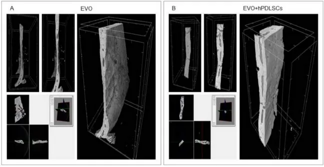 Figure 6. Micro-computed tomography (CT) analyses. 3D volume rendering and 2D virtual sectioning in the 3 orthogonal planes of EVO (A) and EVO + hPDLSCs (B).