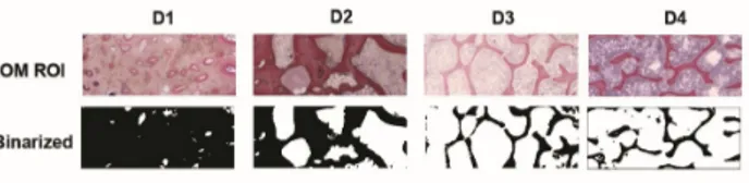 FIG. 1. (color online) Optical microscopy (OM) images of the region of interest (ROI) of the four different densities (D1–D4) bone sites stained with acid fuchsin and toluidine blue and binarized.