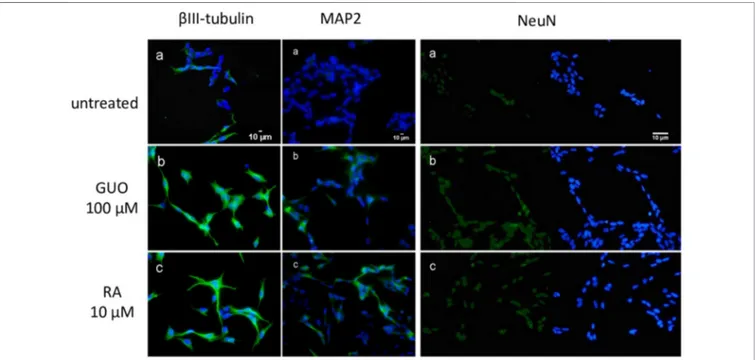 FIGURE 2 | Guanosine increases the expression of speci ﬁc mature neuronal markers in SH-SY5Y neuroblastoma cells
