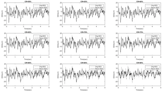 Figure 3. The original EEG recorded at channel E2 (gray) and the related compressively sensed signals (black) reconstructed at different compression rates (CR).