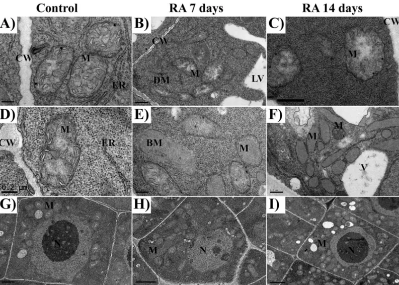 Fig 2. TEM images of rosmarinic acid-treated and untreated Arabidopsis meristems. TEM images of the apical meristem of control (A, D,