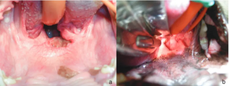 Figure 6. Six-month postoperative direct view of the soft palate: B-dog (a) and NB-dog (b).