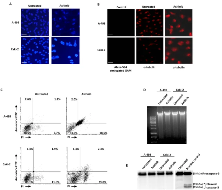 Figure 6: Axitinib induces mitotic catastrophe in RCC cells.  A. Nuclei of RCC cells untreated or treated with axitinib for 96 h 