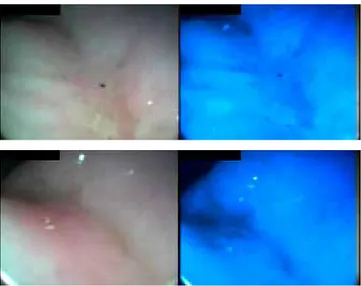 Fig. A1. Case 1. Mesenteric lymph nodes appear ultrasono- ultrasono-graphically very enlarged and inhomogeneous.