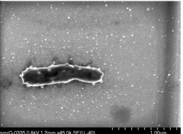 Fig. 1. FE-SEM micrograph of a bacterium producing outer membrane vesicles. Uncoated sample stained with 5% uranyl acetate 