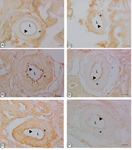 Figure 6. Sections of renal arteries processed for ICAM-1 immunohistochemistry of (A–C) and PECAM-1 (D–F)