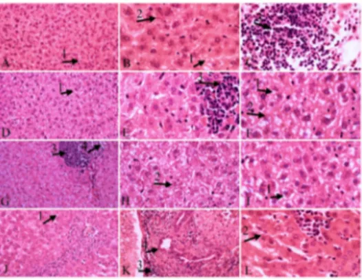 Figure 2. Liver tissue. A, B, C: control group; D, E, F: carvacrol group; G, H, I: glucantime group; J, K, L: thymol group; vacuolar degeneration (1), parasites in hepatocytes (2), inflammatory cells infiltration, hyperemia (3), bill duct hyperplasia (4); 