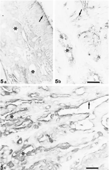 Fig. 5. UEA I staining. Both epithelium (arrow) and ol- ol-factory glands (*) react moderately to UEA I (a); respiratory mucosa shows positive sites at goblet cell (arrow) and gland (*) level (b)