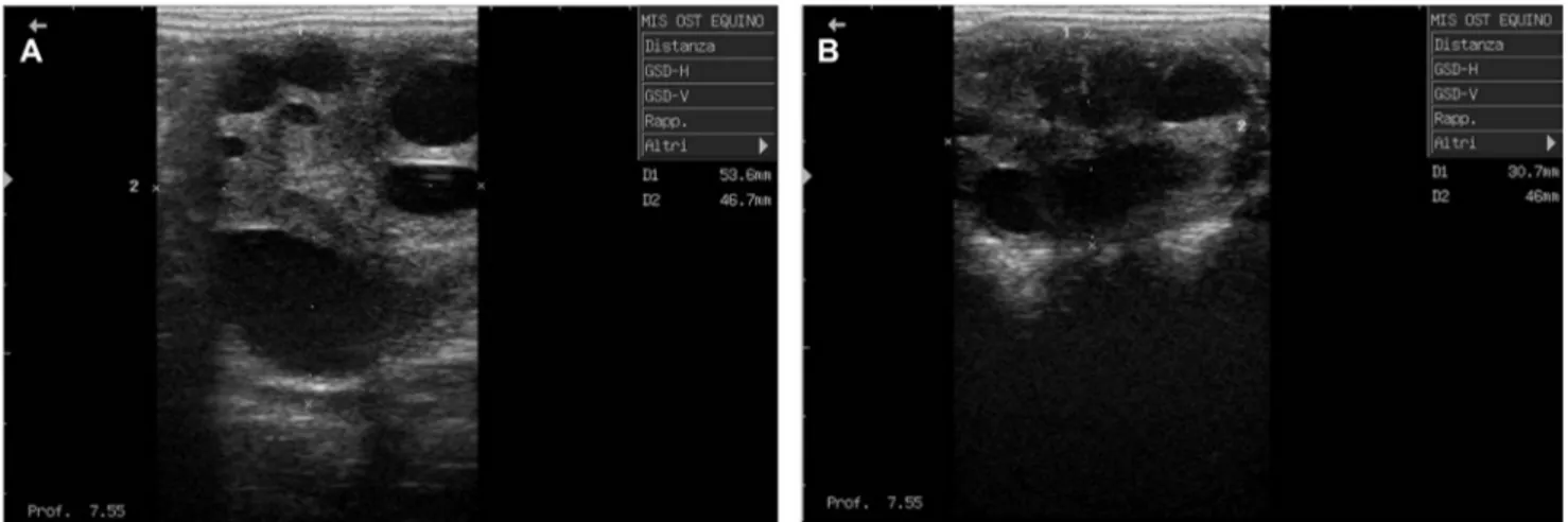 Fig. 1. Longitudinal (A) and transverse (B) images of left ovary of a mare mule showing multiple follicles.