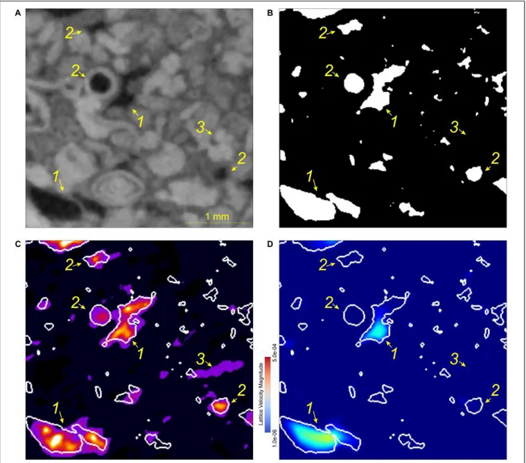 FIGURE 8 | Detail of the comparison of resulting images (Figure 7). (A) XCT at dry conditions, (B) segmented pores from XCT, (C) Difference of NCT wet-dry images using as mask the segmented macropores from the XCT data, warmer colors indicate a higher satu