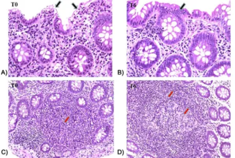 Figure 5. Histological section of descending colon and ileum from HIV-1-positive patients before (T0) and after 6 months of probiotic supplementation (T6)