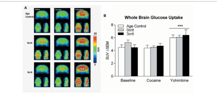 FigUre 2 | Whole brain glucose uptake in Age Control, 0crit and 3crit rats. (a) Average reconstructions of microPET scans showing [18F]-fluorodeoxyglucose 