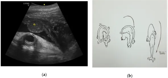 Figure 12. (a) Using the CL as a reference, if the fetus skull is located close to the CL, it will have a 