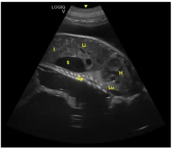Figure 7. Fetal spinal cord (Sp), stomach (S), liver (Li), intestine (I), lungs (Lu), and heart (H) were 