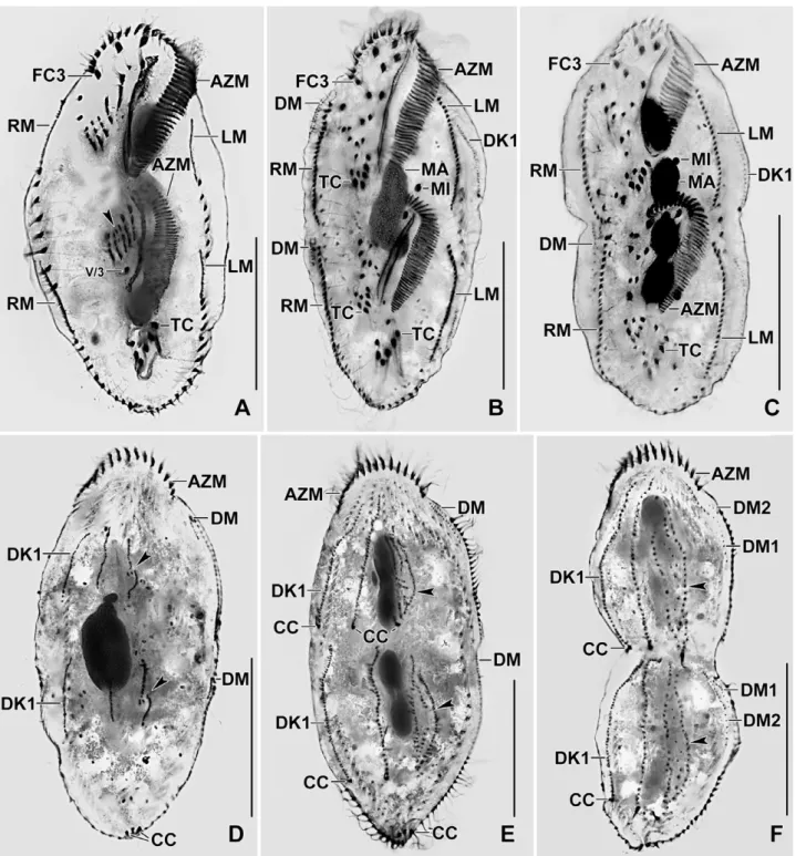 Figure 6 Photomicrographs of Rigidocortex quadrinucleatus after protargol impregnation