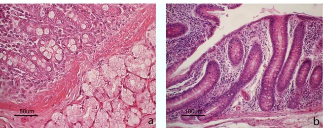 Figure S1 Light micrograph of (a) duodenum and (b) colon. In the  duodenum, glandular crypts and serous  duodenal  glands  in  the  tunica  submucosa  are  showed
