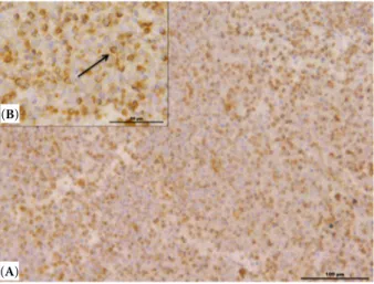 Figure 2. Spleen of an African lion with chronic lym- lym-phocytic leukaemia. (A) Neoplastic lymphocytes are  immunoreactive for CD79a antibody