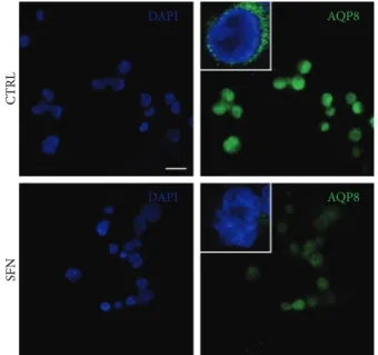 Figure 4: Eﬀect of SFN on intracellular ROS level in B1647 cell line. B1647 cells were incubated for 24 h with di ﬀerent SFN concentrations