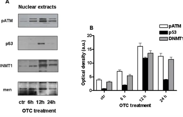 Figure 2 OTC induces genotoxic damage. Cells were treated with OTC for 6, 12 and 24 h and processed as indicated in ‘Material and Methods’