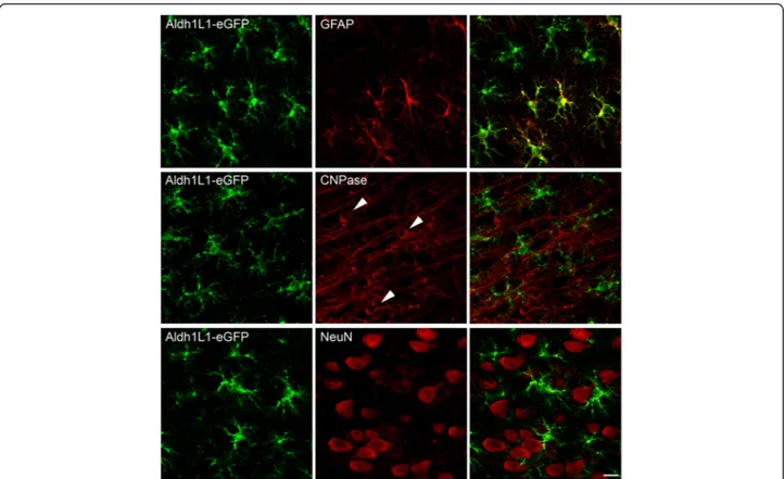 Fig. 1 ALDH1L1-eGFP expression is specific for astrocytes. Top panels: Double-labeling studies showing colocalization of ALDH1L1-eGFP (green) and the astrocytic marker GFAP (red)