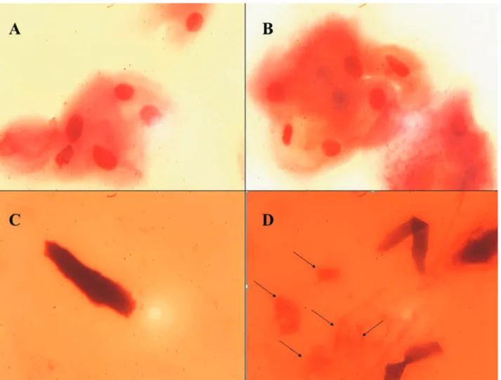 Fig. 1. Microscopic image of (A, B) gingival swab with giant intermediate squamous epithelial cells with pink-colored abundant cytoplasm where oral bacterial strains can adhere; (C) ear swab with a papyrus-like enrolled elongated lanceolate corneocyte; (D)