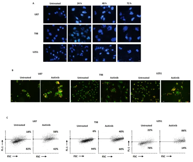 Figure 3: Axitinib triggers mitotic catastrophe in all glioma cell lines.  A. Nuclei of glioma cells untreated or treated with axitinib  for the indicated time were stained with Hoechst 33258 and then analyzed on ten random fields