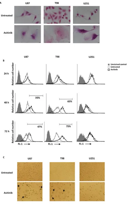 Figure 4: Axitinib induces cellular senescence in U87 and T98, but not in U251 glioma cell lines