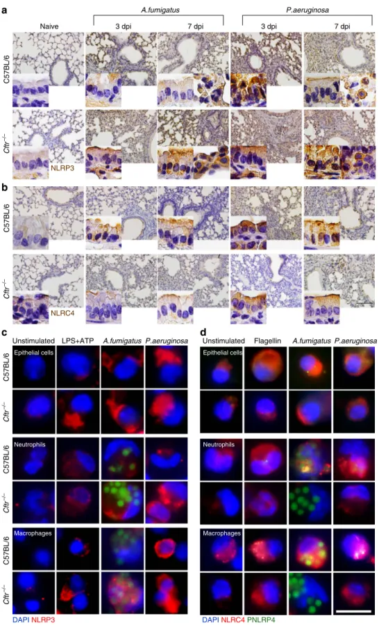 Figure 2 | Different NLRP3 and NLRC4 expression in lung cells from CF mice. C57BL/6 and Cftr  /  mice (n ¼ 6 for all groups) were infected intranasally with live A