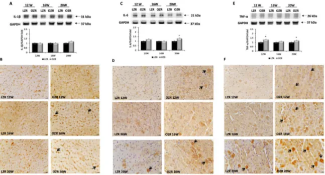 Figure 6. Inflammation. Lysates of heart from lean Zucker rats (LZR) and obese Zucker rats (OZR) at the age of 12, 16, and 20 weeks were immunoblotted using specific anti: (A) interleukin 1 beta (IL-1β); (C) interleukin 6 (IL-6); (E) tumor necrosis factor 