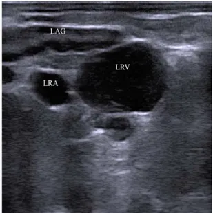 Fig. 1: Caudal part of the left adrenal gland (LAG). Left renal vein (LRV)  and artery (LRA) are seen adjacent to the gland