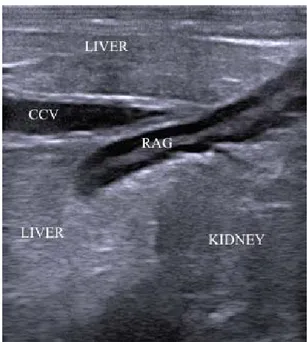 Fig. 5: The slightly S-shaped right adrenal gland (RAG) is embedded  between renal and hepatic parenchyma and adjacent to the caudal cava  vein (CCV)