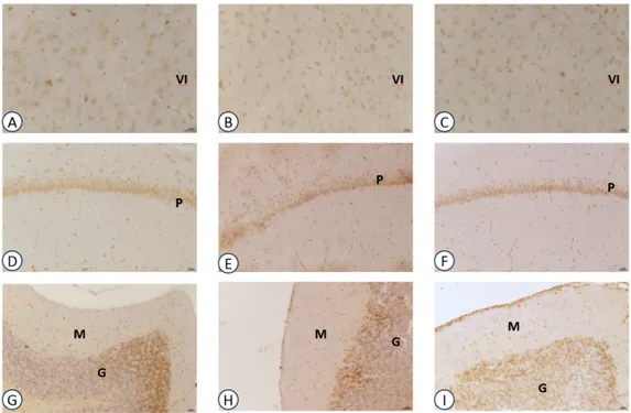 Figure 3. Sections of the frontal cortex (A–C), hippocampus (D–F), cerebellum (G–I) processed for IL-